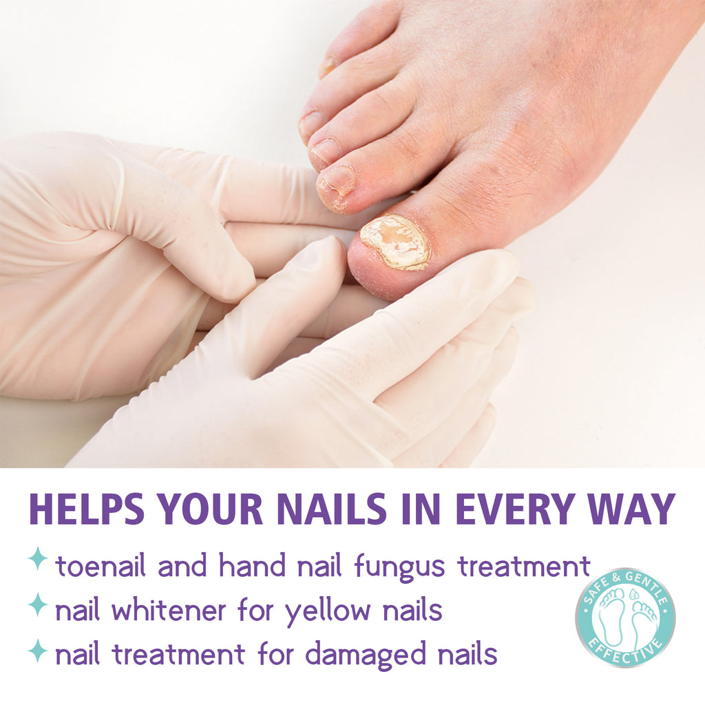 • NAIL FANGUS SPRAY