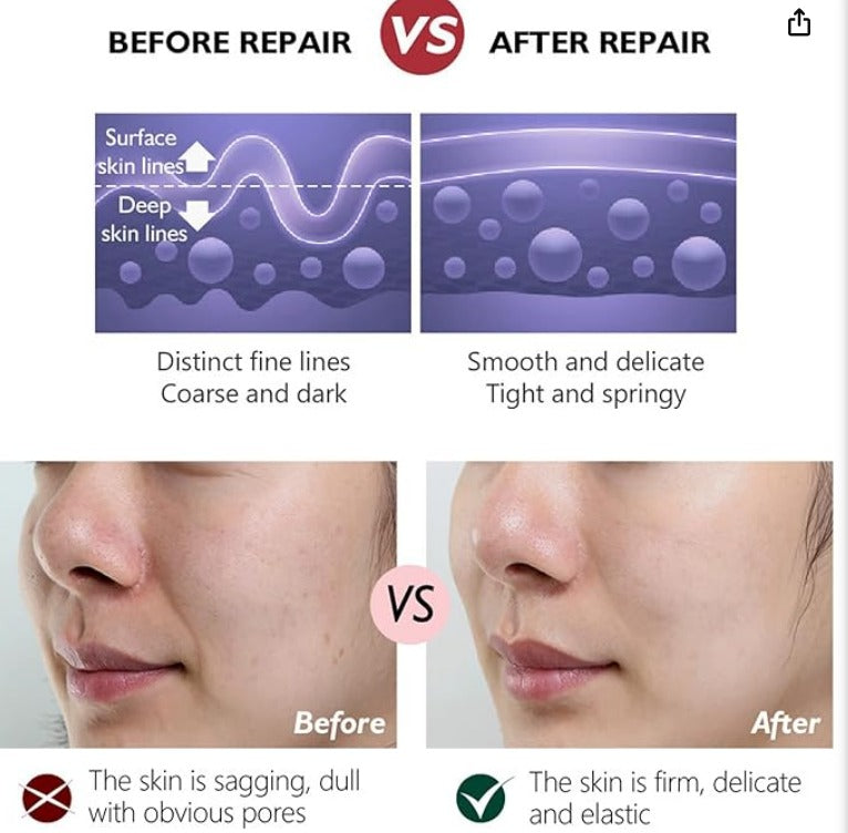 • Retinol cream (Anti-Aging)