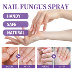 عرض 2 قطعة من NAIL FANGUS SPRAY