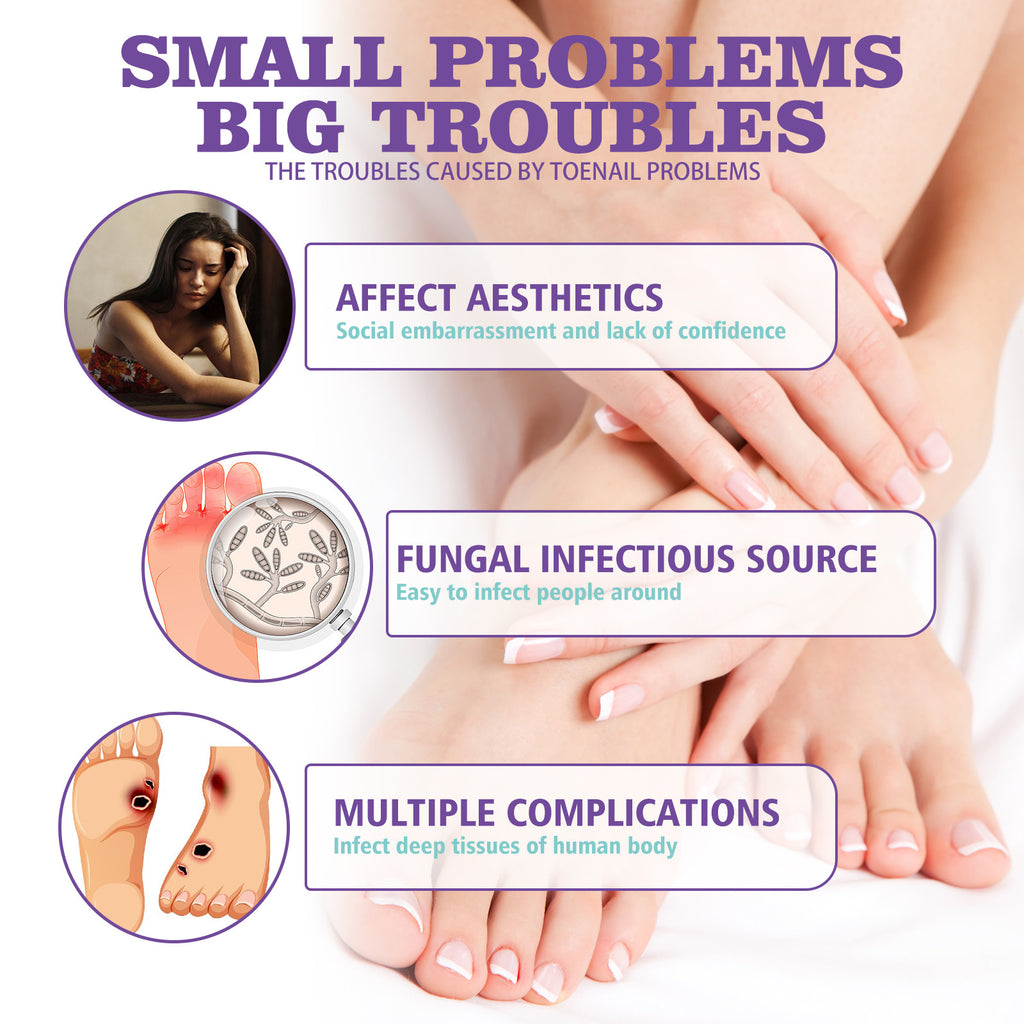 عرض 2 قطعة من NAIL FANGUS SPRAY