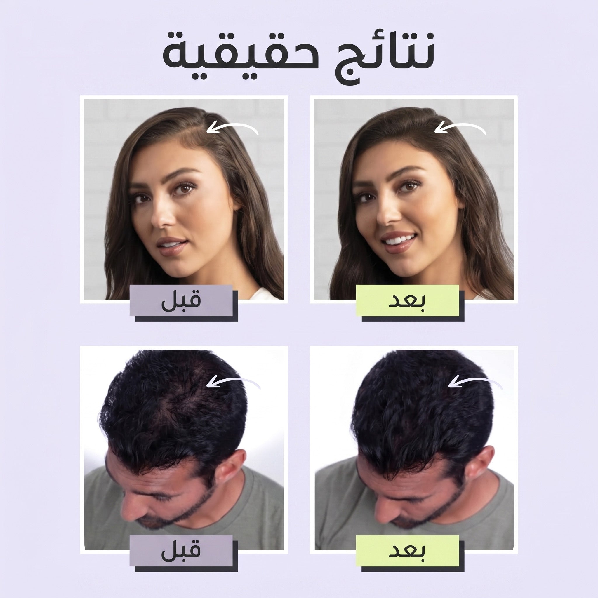 Toppik Hair Fibers لفراغات الشعر