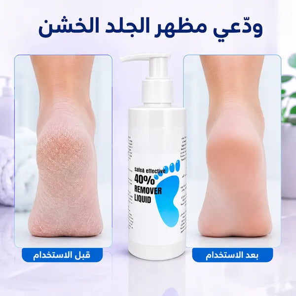 جل لإزالة الجلد السميك من القدمين