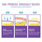 عرض 2 قطعة من NAIL FANGUS SPRAY