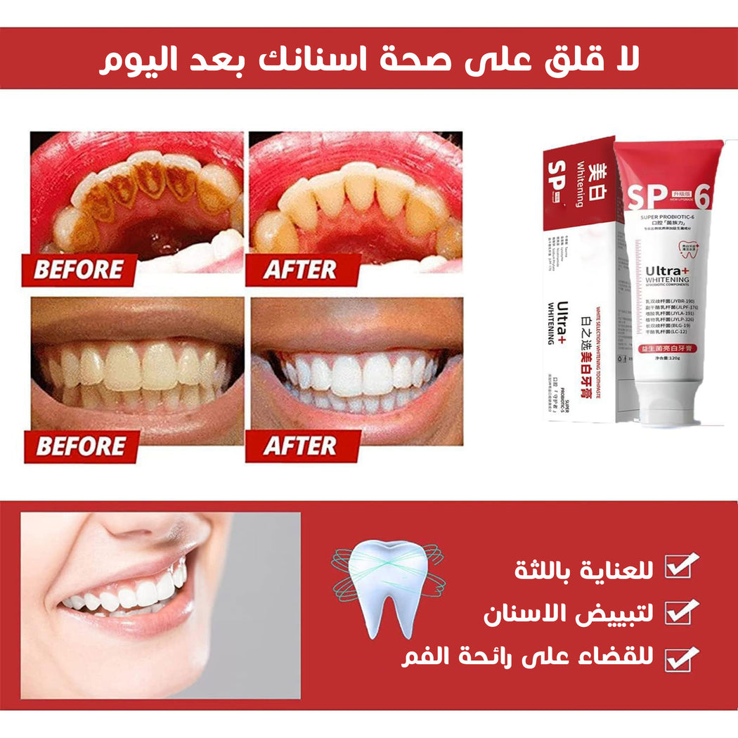 • معجون لتبيض الاسنان SP6