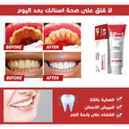 • معجون لتبيض الاسنان SP6