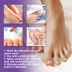 عرض 2 قطعة من NAIL FANGUS SPRAY