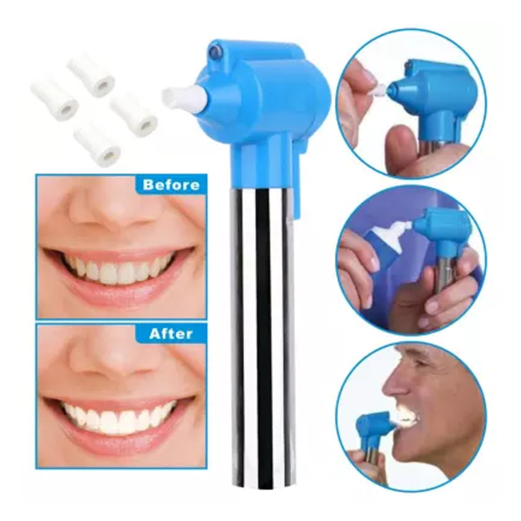 Luma Smile تبييض الأسنان