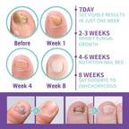 • NAIL FANGUS SPRAY