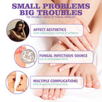 • NAIL FANGUS SPRAY