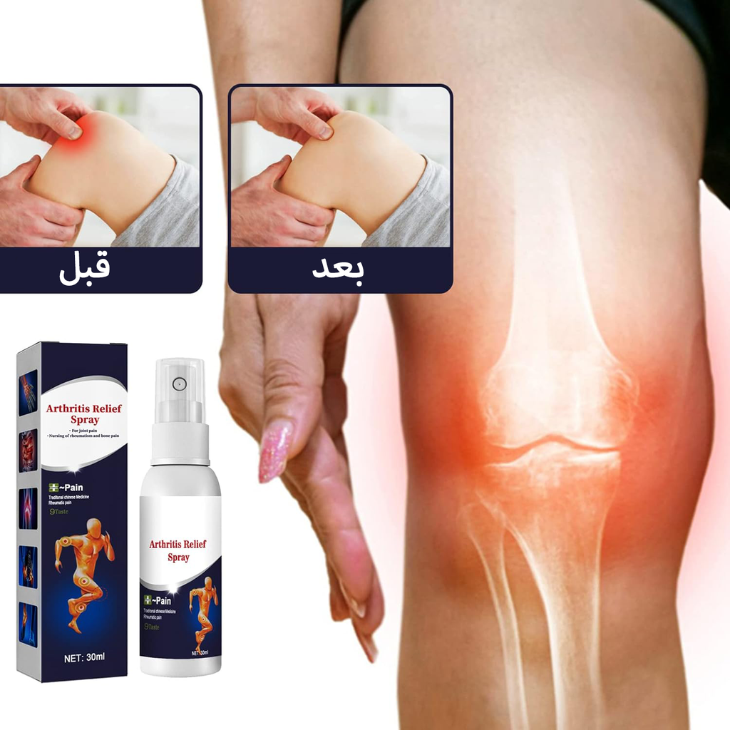 • سبراي المفاصل السحري